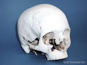 Skull